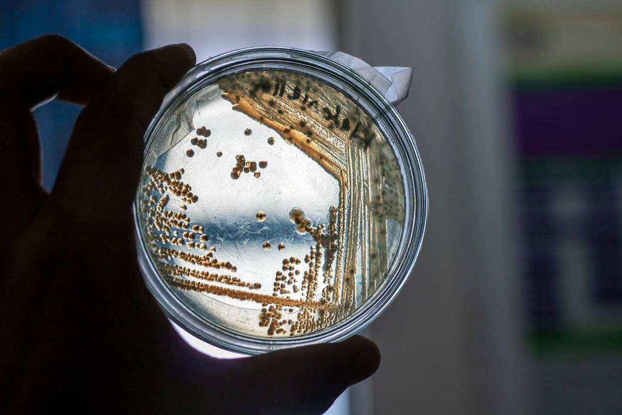A hand holding a petri dish with brown bacterial colonies up to the light