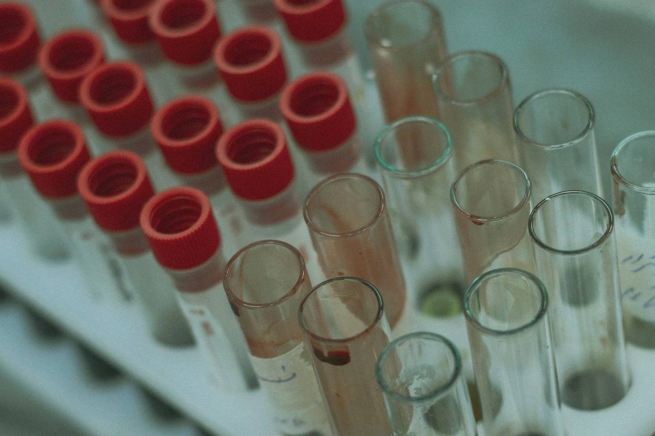 Rows of red-capped sample tubes beside empty glass test tubes in a laboratory rack